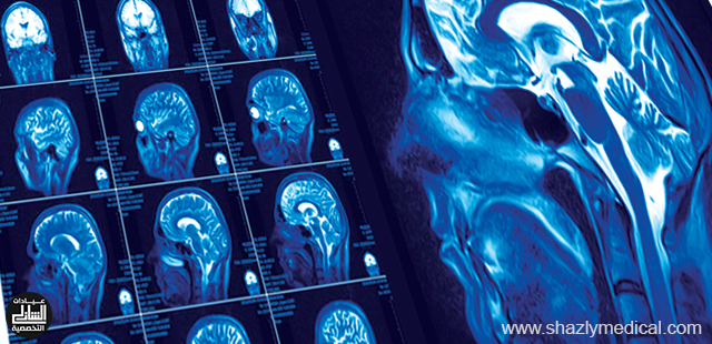 Photo of اشعة الرنين المغناطيسي MRI اقوى وادق أداة تشخيصية في العالم